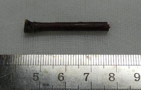 “小小竹棍把我害的好苦啊!幸好，遇到了厦门眼科中心眼整形科的胡继发副主任。医术好、态度好。大医院 医生就是不一样!”——医治眼睛后的老李激动的说道2.jpg