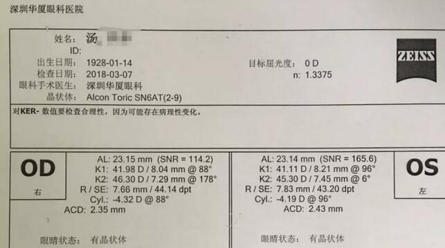 3月12日下午，已经90高龄的离休东江纵队老兵汤爷爷，在深圳华厦眼科医院检查之后，白内障专科邢宝刚主任为其实施左眼白内障超声乳化摘除，联合散光人工晶体植入术。2.jpg