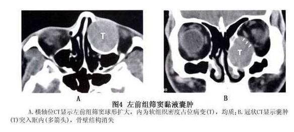 4月7-8日，天津医科大学眼科医院副院长、天津医科大学眼视光学院副院长、中华眼科学会委员、眼整形、眼眶病学组副组长孙丰源教授将莅临福州眼科医院2.jpg
