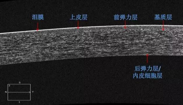 华厦眼科课堂：后节频域OCT前节模块的运用2.jpg