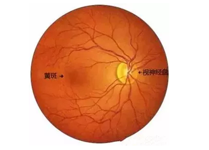 华厦福州眼科医院眼底病医生：老年黄斑变性该如何防治？.png