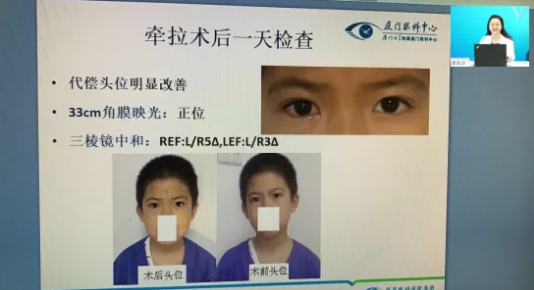 高峰论道·云端荟萃 ▏万人同步在线，30余名大咖云集“第六届华厦眼科论坛斜视与小儿眼科新技术学习班暨小儿、眼视光分论坛”7.png
