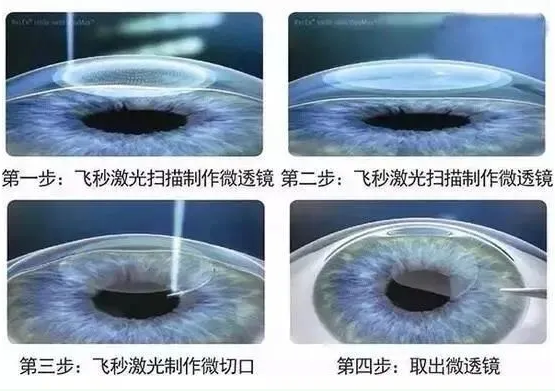 2021年征兵准备工作已经全面展开，视力不够的看过来2.png