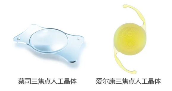 我看到了9个月亮，中国医生一招解决！“洋女婿”患白内障几近失明，在厦门眼科中心手术4.png